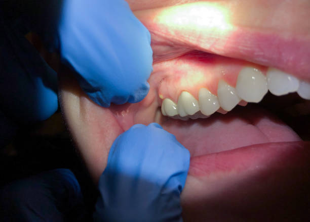 Best Broken or Cracked Tooth Emergency Dentist in Wallace, FL