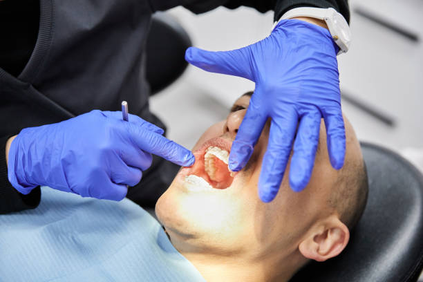 Best Emergency Dentist for Knocked-Out Tooth in Wallace, FL