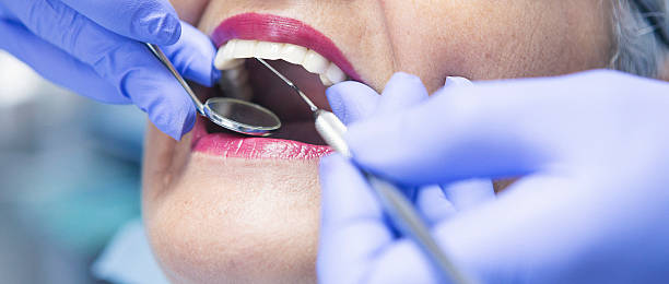Best Emergency Dentist for Knocked-Out Tooth in Wallace, FL